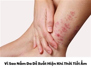Vì Sao Nấm Da Dễ Xuất Hiện Khi Thời Tiết Ẩm