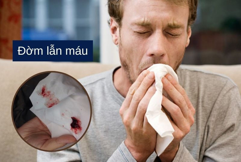Triệu chứng của ung thư phổi